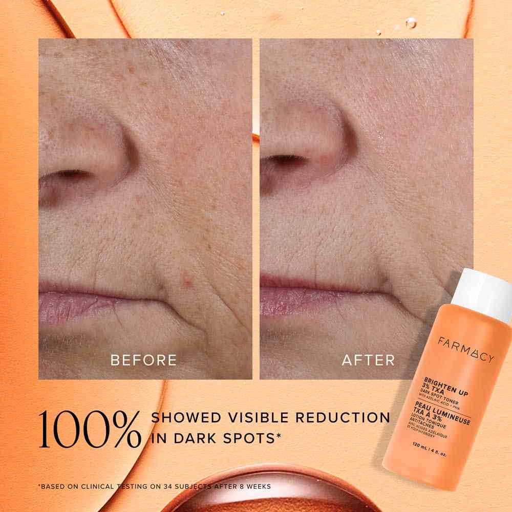 Brighten Up 3% TXA Dark Spot Toner • 50ml