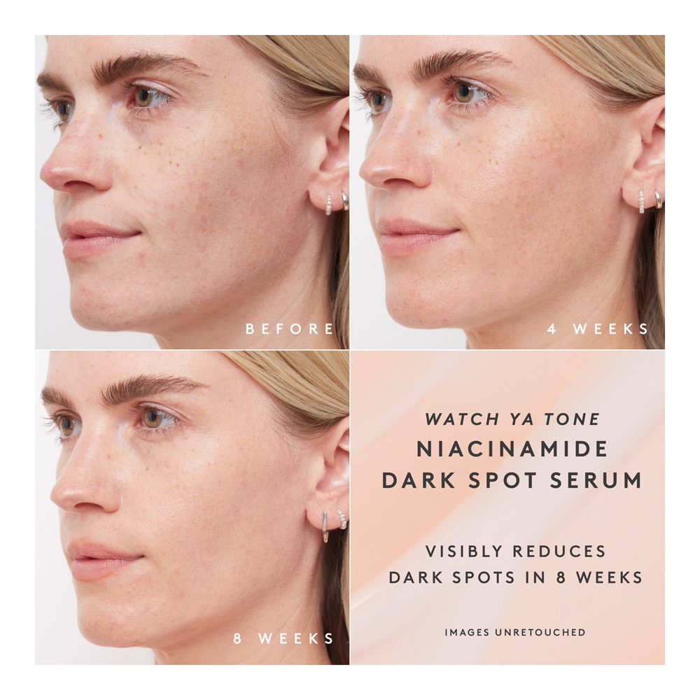 Watch Ya Tone Niacinamide Dark Spot Serum • 30ml