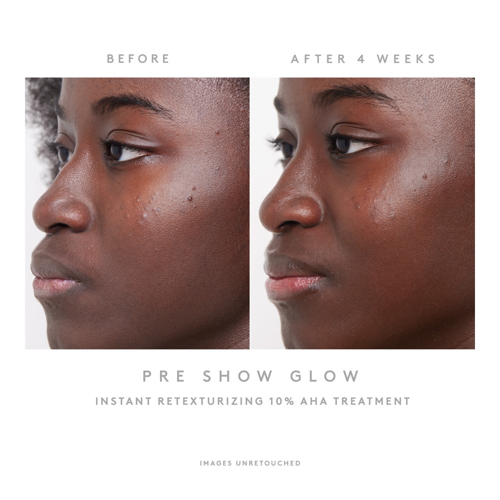 Pre-Show Glow Instant Retexturizing 10% AHA Treatment + Reusable Applicator • 30ml