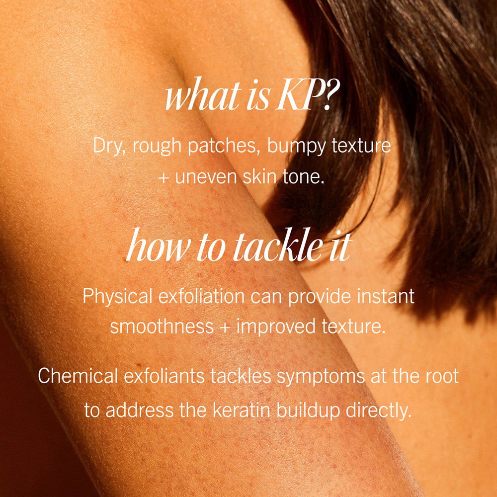 KP Bump Eraser Body Scrub With 10% AHA Fresh Peach • 56.7g