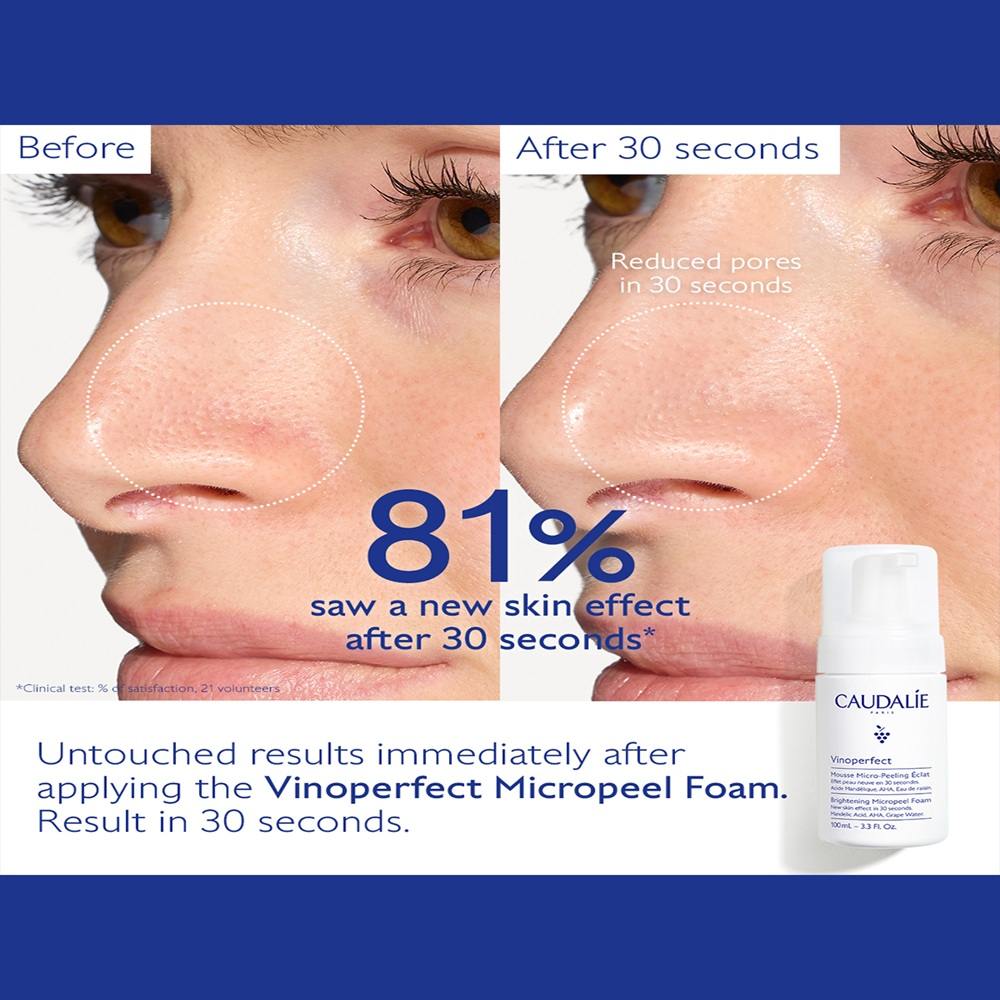 Vinoperfect Instant Brightening Micropeel • 50ml