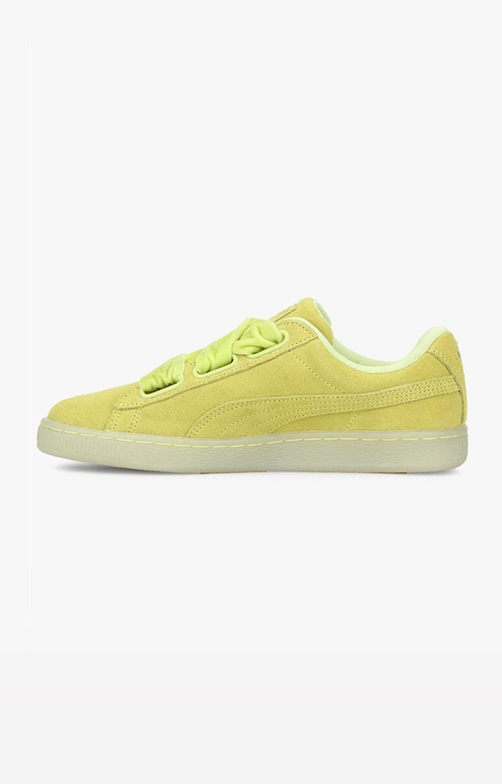Yellow Sneakers