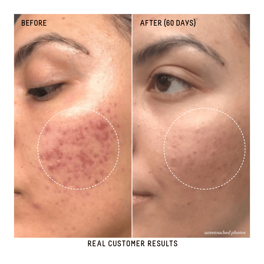 Squalane + Vitamin C Dark Spot Serum • 30ml