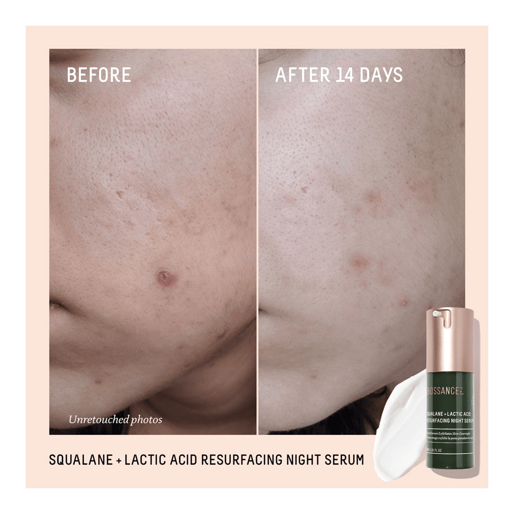 Squalane + 10% Lactic Acid Resurfacing Serum • 30ml