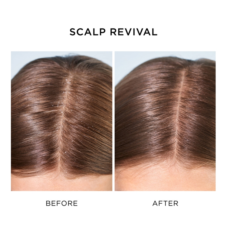 Scalp Revival™ Charcoal + Peppermint Oil Cooling Jelly Conditioner • 226ml