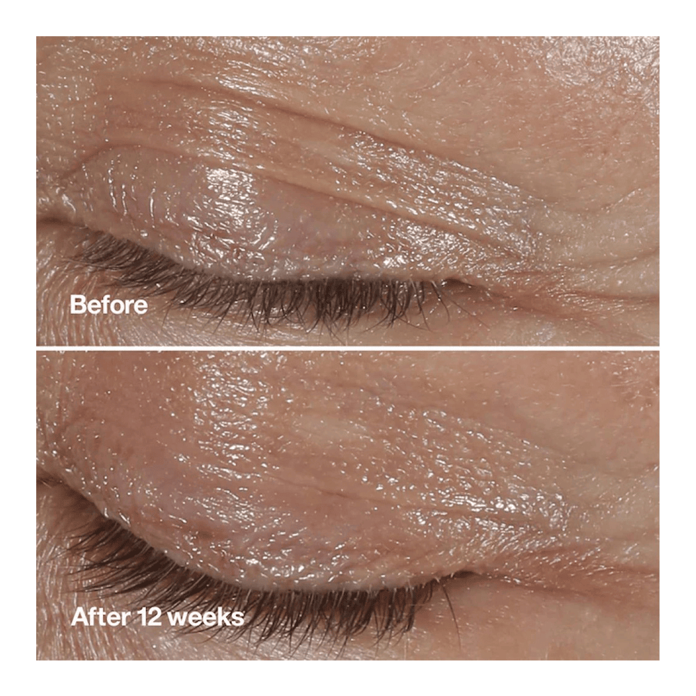 Smart Clinical Repair™ Wrinkle Correcting Eye Cream • 15ml