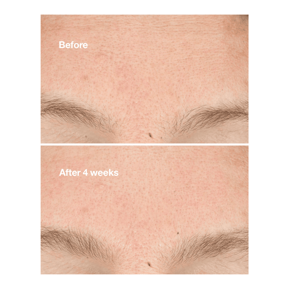 Clarifying Do-Over Peel • 30ml