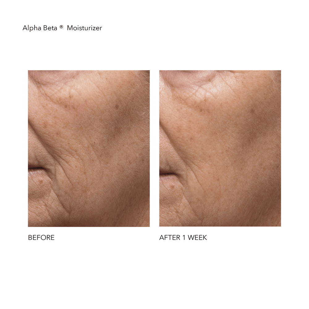 Alpha Beta Daily Moisturizer • 50ml