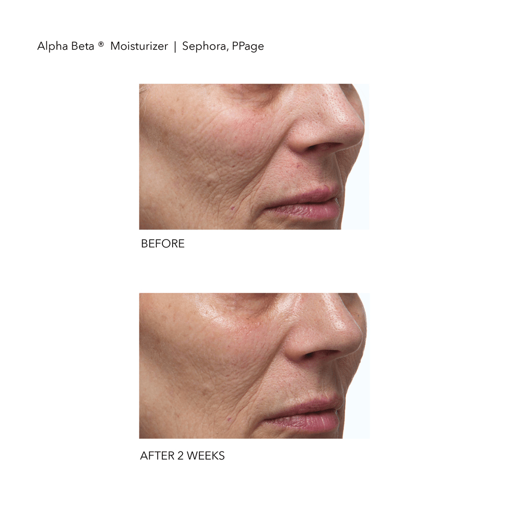 Alpha Beta Daily Moisturizer • 50ml