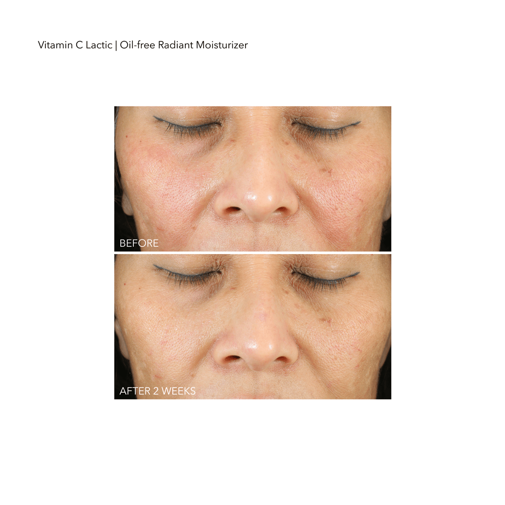 VitaminC Lactic Oil-Free Radiant Moisturizer • 50ml