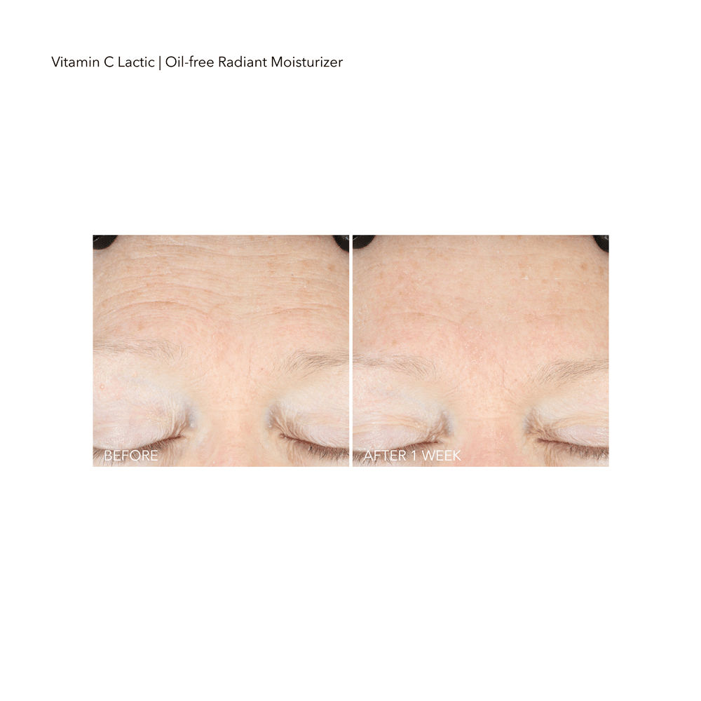 VitaminC Lactic Oil-Free Radiant Moisturizer • 50ml