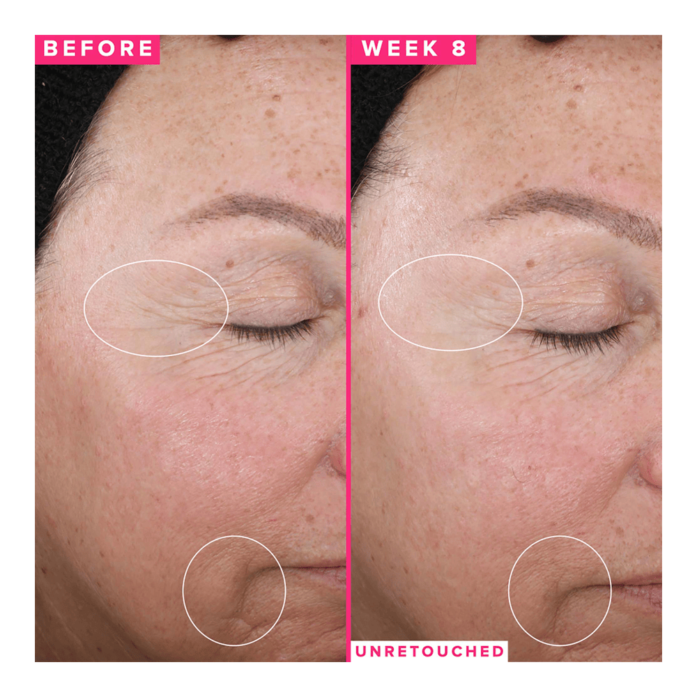 1% Vitamin A Retinol Serum • 30ml