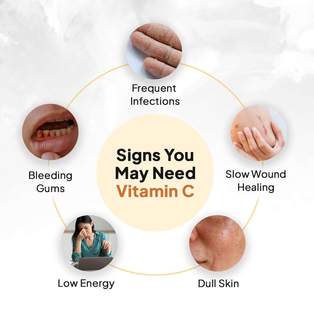 Miduty | Liposomal Vitamin C | Immunity Booster | 30 Cap