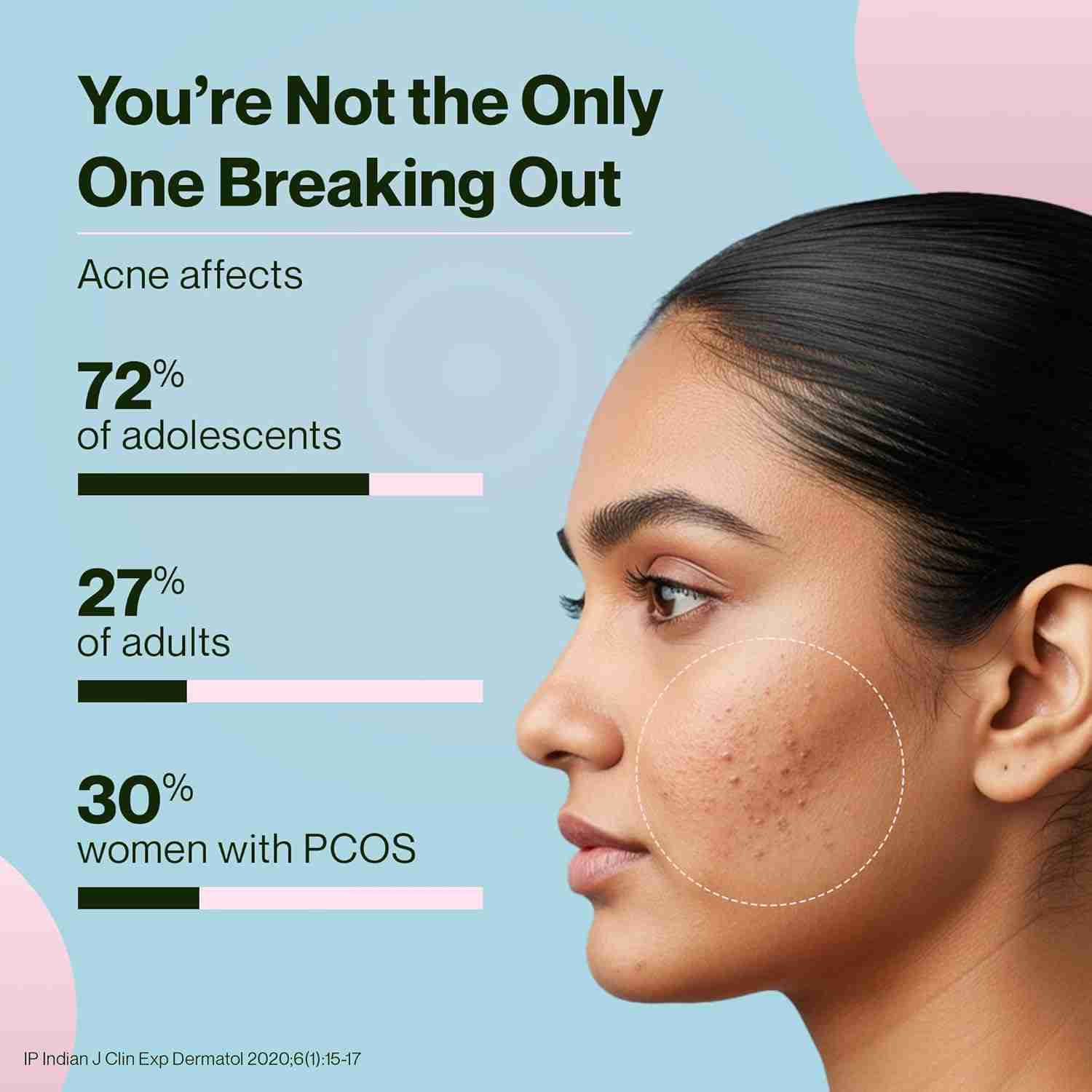 Setu Skin: AcneClear | Target Hormonal & PCOS Acne at the Root | Formulated with BIFIACNEL®, Chasteberry, Chamomile, Magnesium and Supergreens for Gut detox & Skin Health | Green Apple Flavour | 30 Sachets